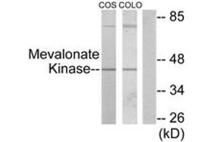Western blot analysis of extracts from COS7/COLO205 cells, using Mevalonate Kinase Antibody. (MVK 抗体  (AA 151-200))