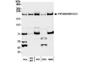 Western Blotting (WB) image for anti-RB1-Inducible Coiled-Coil 1 (RB1CC1) (AA 1544-1594) antibody (ABIN7451783)