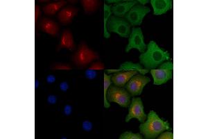 ABIN6257594 and ABIN6275624 staining Hela cells by IF/ICC. (CCT7 抗体  (Internal Region))