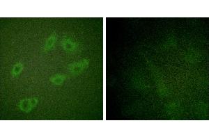 P-peptide - +Immunofluorescence analysis of HuvEc cells, using HER3/ErbB3 (Phospho-Tyr1222) antibody. (ERBB3 抗体  (pTyr1222))