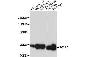 Western blot analysis of extracts of various cell lines, using SCYL2 antibody (ABIN6293549) at 1:3000 dilution.