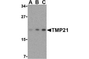 Western Blotting (WB) image for anti-Transmembrane Emp24-Like Trafficking Protein 10 (TMED10) (Middle Region) antibody (ABIN1031137) (TMED10 抗体  (Middle Region))