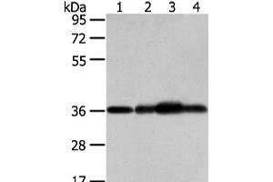 Western Blot analysis of Mouse brain tissue, hepg2, 293T and 231 cell using STX12 Polyclonal Antibody at dilution of 1/800 (Syntaxin 12 抗体)