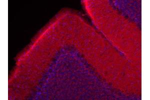Indirect immunolabeling of mouse cerebellum (PFA fixed and ice-cold methanol for 2 min) (red; dilution 1 : 200). (beta Actin 抗体)
