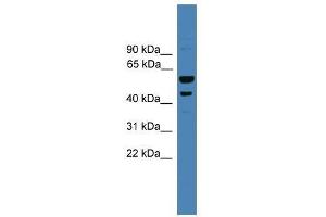 SERPINB2 antibody used at 0. (SERPINB2 抗体  (Middle Region))