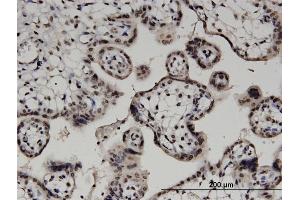 Immunoperoxidase of monoclonal antibody to DGKA on formalin-fixed paraffin-embedded human placenta. (DGKA 抗体  (AA 1-735))