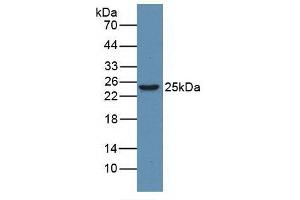 Detection of HMGB1 in Human Jurkat Cells using Monoclonal Antibody to High Mobility Group Protein 1 (HMGB1) (HMGB1 抗体  (AA 1-215))