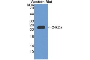 Detection of Recombinant NCF2, Human using Polyclonal Antibody to Neutrophil Cytosolic Factor 2 (NCF2) (NCF2 抗体  (AA 355-526))