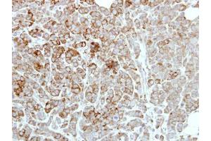 IHC-P Image Immunohistochemical analysis of paraffin-embedded MDAMB468 xenograft, using PDE1A, antibody at 1:500 dilution. (PDE1A 抗体)