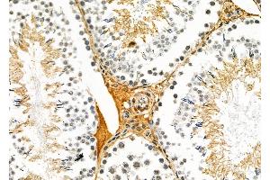 ABIN6260068 and ABIN6279106 at 1/100 staining Rat testis tissue by IHC-P. (ACER1 抗体  (Internal Region))