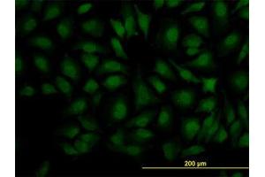 Image no. 3 for anti-Decapping Enzyme, Scavenger (DCPS) (AA 1-338) antibody (ABIN599227) (DCPS 抗体  (AA 1-338))