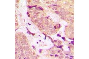 Immunohistochemistry (IHC) image for anti-TNF Receptor-Associated Factor 2 (TRAF2) antibody (ABIN7308436) (TRAF2 抗体)