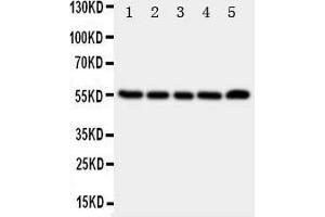 Western Blotting (WB) image for anti-Tachykinin Receptor 1 (TACR1) (AA 231-245), (Middle Region) antibody (ABIN3044262) (TACR1 抗体  (Middle Region))