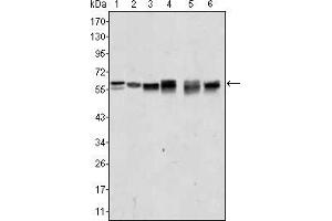 Western blot analysis using AKT2 mouse mAb against A431 (1), Jurkat (2), HEK293 (3), A549 (4), MCF-7 (5) and PC-12 (6) cell lysate. (AKT2 抗体)
