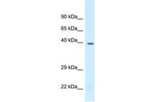 Image no. 1 for anti-D4, Zinc and Double PHD Fingers, Family 3 (DPF3) (N-Term) antibody (ABIN6747723)