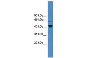 Image no. 1 for anti-Zinc Finger Protein 265 (Zranb2) (AA 101-150) antibody (ABIN6745453) (ZNF265 抗体  (AA 101-150))