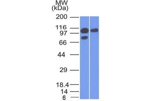 Western Blot of A431 and MCF-7 cell lysate using Catenin, alpha-1 Mouse Monoclonal Antibody (1G5). (CTNNA1 抗体)