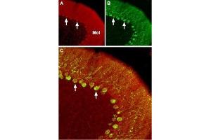 Expression of CaV2. (CACNA1B 抗体  (Intracellular))