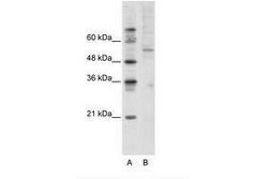 Image no. 1 for anti-Activating Transcription Factor 7 (AFT7) (C-Term) antibody (ABIN202638) (AFT7 抗体  (C-Term))