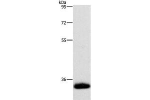 Western Blot analysis of Human testis tissue using AMBP Polyclonal Antibody at dilution of 1:500 (AMBP 抗体)