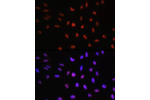 Immunofluorescence analysis of U-2 OS cells using TCF4 Rabbit pAb (ABIN3021529, ABIN3021530, ABIN3021531, ABIN1513591 and ABIN6215200) at dilution of 100 (40x lens). (TCF4 抗体  (AA 400-500))