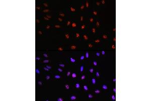 Immunofluorescence analysis of U-2 OS cells using TCF4 Rabbit pAb (ABIN3021529, ABIN3021530, ABIN3021531, ABIN1513591 and ABIN6215200) at dilution of 100 (40x lens). (TCF4 抗体  (AA 400-500))