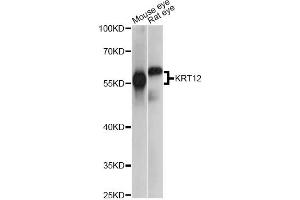 Western blot analysis of extracts of various cell lines, using KRT12 antibody. (KRT12 抗体)