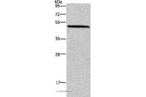 Western blot analysis of Mouse brain tissue, using HOMER1 Polyclonal Antibody at dilution of 1:400 (HOMER1 抗体)