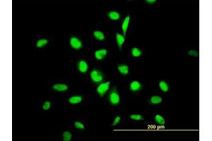 Immunofluorescence of monoclonal antibody to YY1 on HeLa cell. (YY1 抗体  (AA 221-320))