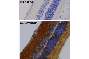 Immunohistochemistry (IHC) image for anti-Catenin, beta (CATNB) (C-Term) antibody (ABIN6254224) (beta Catenin 抗体  (C-Term))