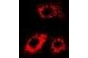 Immunofluorescent analysis of Citrate Synthase staining in MCF7 cells. (CS 抗体)