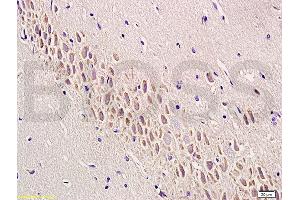 Formalin-fixed and paraffin embedded rat brain labeled with Anti-SEMA7A/CD108 Polyclonal Antibody, Unconjugated (ABIN749363) at 1:200 followed by conjugation to the secondary antibody and DAB staining (SEMA7A 抗体  (AA 351-450))