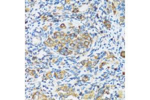 Immunohistochemistry of paraffin-embedded rat ovary using F antibody (ABIN3016158, ABIN3016159, ABIN3016160 and ABIN6219586) at dilution of 1:100 (40x lens). (APOBEC3F 抗体  (AA 1-65))