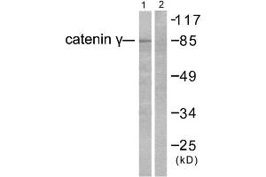 Western Blotting (WB) image for anti-Junction Plakoglobin (JUP) (C-Term) antibody (ABIN1848448) (JUP 抗体  (C-Term))