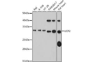 Western blot analysis of extracts of various cell lines, using UCP2 antibody (ABIN1683207, ABIN3018658, ABIN3018659 and ABIN5664678) at 1:1000 dilution. (UCP2 抗体)