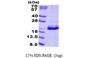 SDS-PAGE (SDS) image for Signal Recognition Particle 19kDa (SRP19) (AA 1-144) protein (His tag) (ABIN5852991)
