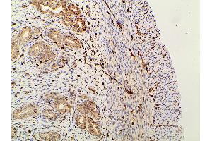 Immunohistochemistry (IHC) image for anti-Phosphoinositide 3 Kinase, p85 alpha (PI3K p85a) (pTyr607) antibody (ABIN6256775)