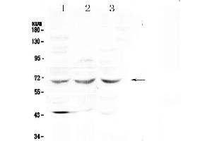 Western blot analysis of SPHK2 using anti-SPHK2 antibody . (SPHK2 抗体  (AA 215-269))