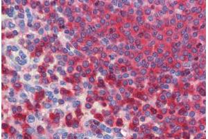 anti-Glucose-6-Phosphate Dehydrogenase (G6PD) (AA 35-506) antibody