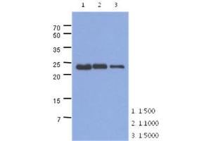 The extracts of mouse muscle (40ug) were resolved by SDS-PAGE, transferred to PVDF membrane and probed with anti-human TNNI1 antibody (1:500 ~ 1:5000). (TNNI1 抗体)