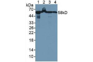 Western blot analysis of (1) Rat Liver Tissue, (2) Rat Pancreas Tissue, (3) Human A549 Cells and (4) Human MCF Cells. (HSPD1 抗体  (AA 1-573))