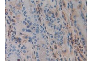 Immunohistochemistry (IHC) image for anti-ADAM Metallopeptidase Domain 10 (ADAM10) (AA 420-641) antibody (ABIN7432559)