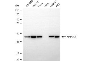 Western blotting analysis using MAP2K2 antibody (ABIN7799464).