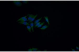 Detection of CD5 in Human HepG2 cell using Polyclonal Antibody to Cluster Of Differentiation 5 (CD5) (CD5 抗体  (AA 25-372))