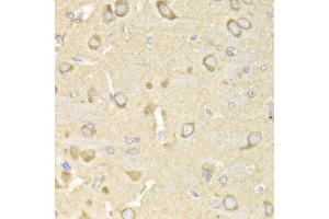 Immunohistochemistry of paraffin-embedded rat brain using TRAP1 Antibody (ABIN1875197) at dilution of 1:200 (40x lens). (TRAP1 抗体)