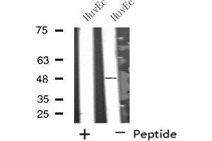 Western blot analysis of extracts from HuvEc cells, using SYT13 antibody. (SYT13 抗体  (Internal Region))