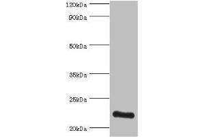 Western blot All lanes: ATP5O antibody at 3 μg/mL + HepG2 whole cell lysate Secondary Goat polyclonal to rabbit IgG at 1/10000 dilution Predicted band size: 23 kDa Observed band size: 23 kDa (ATP5O 抗体  (AA 24-213))