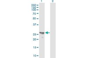 Western Blot analysis of BPHL expression in transfected 293T cell line by BPHL MaxPab polyclonal antibody. (BPHL 抗体  (AA 1-274))