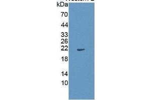 WB of Protein Standard: different control antibodies  against Highly purified E. (IL1A ELISA 试剂盒)