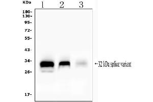Western blot analysis of FHL using anti-FHL antibody (ABIN7599209).